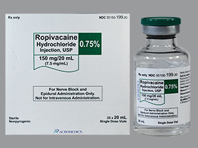 ROPIVACAINE 0.75% 150 MG/20 ML