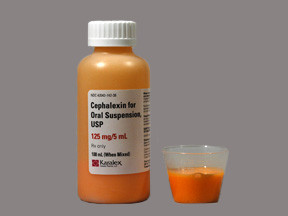 CEPHALEXIN 125 MG/5 ML SUSP