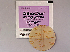 NITRO-DUR 0.6 MG/HR PATCH