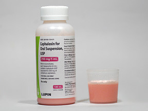 CEPHALEXIN 250 MG/5 ML SUSP