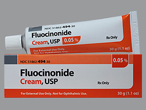 FLUOCINONIDE 0.05% CREAM