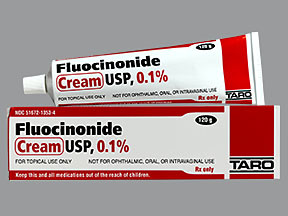 FLUOCINONIDE 0.1% CREAM