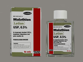 MALATHION 0.5% LOTION