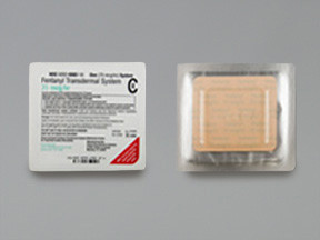 FENTANYL 75 MCG/HR PATCH