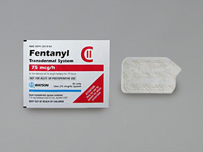 FENTANYL 75 MCG/HR PATCH